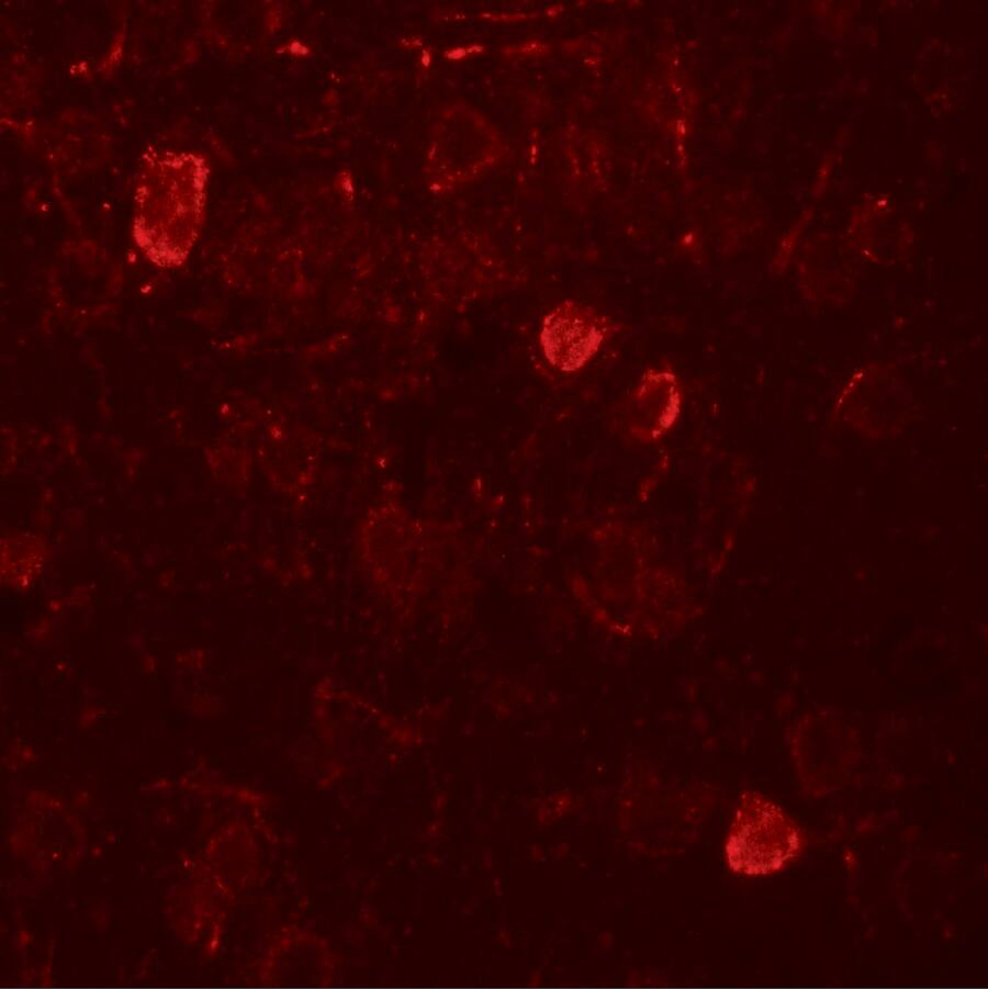 Immunocytochemistry/ Immunofluorescence: NELF Antibody - BSA Free [NBP2-81759] - Immunofluorescence of NELF in rat brain tissue with NELF antibody at 20 u/ml.