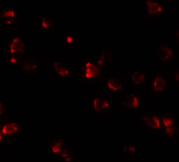 Immunocytochemistry/ Immunofluorescence: NKX2-4 Antibody - BSA Free [NBP2-81760] - Immunofluorescence of NKX2-4 in A20 cells with NKX2-4 antibody at 20 ug/mL.