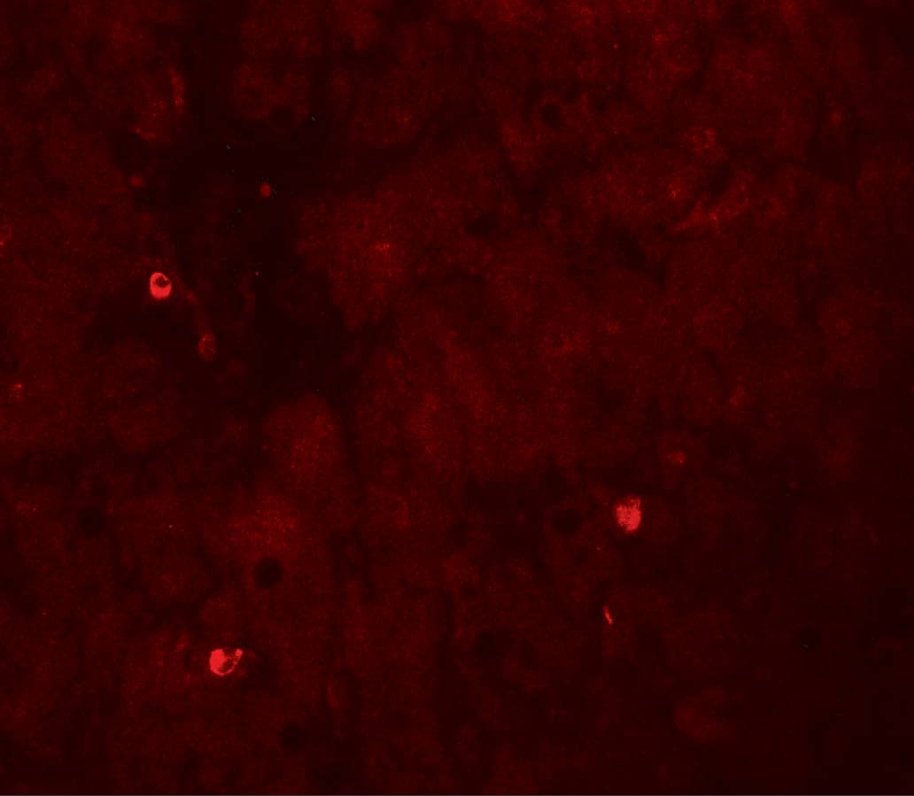 Immunocytochemistry/ Immunofluorescence: TIF1 gamma Antibody - BSA Free [NBP2-81762] - Immunofluorescence of TIF1 gamma in human liver tissue with TIF1 gamma antibody at 20 ug/ml.