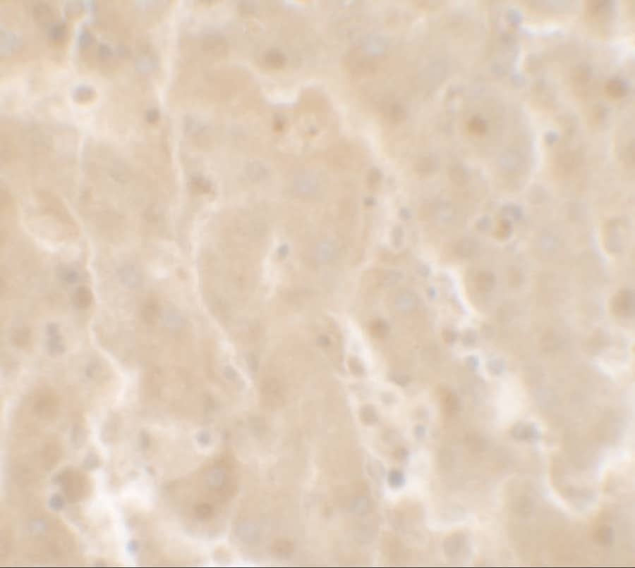 Immunohistochemistry: TIF1 gamma Antibody - BSA Free [NBP2-81762] - Immunohistochemistry of TIF1 gamma in human liver tissue with TIF1 gamma antibody at 2.5 ug/ml.