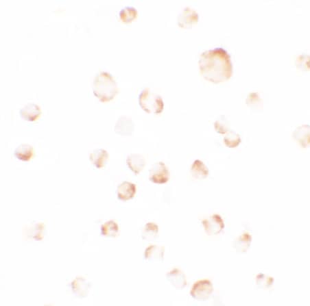 Immunocytochemistry/ Immunofluorescence: PHLPP Antibody - BSA Free [NBP2-81766] - Immunocytochemistry of PHLPP in SW480 cells with PHLPP antibody at 2.5 ug/ml.