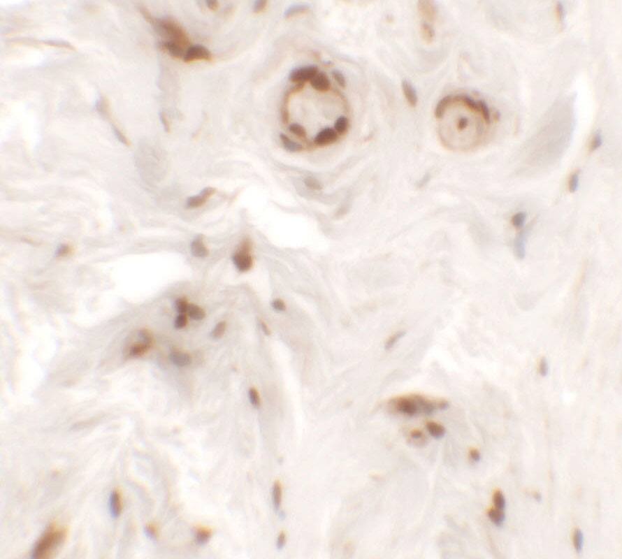 Immunohistochemistry: Uroplakin Ib Antibody - BSA Free [NBP2-81768] - Immunohistochemistry of Uroplakin Ib in human bladder tissue with Uroplakin Ib antibody at 5 ug/mL.