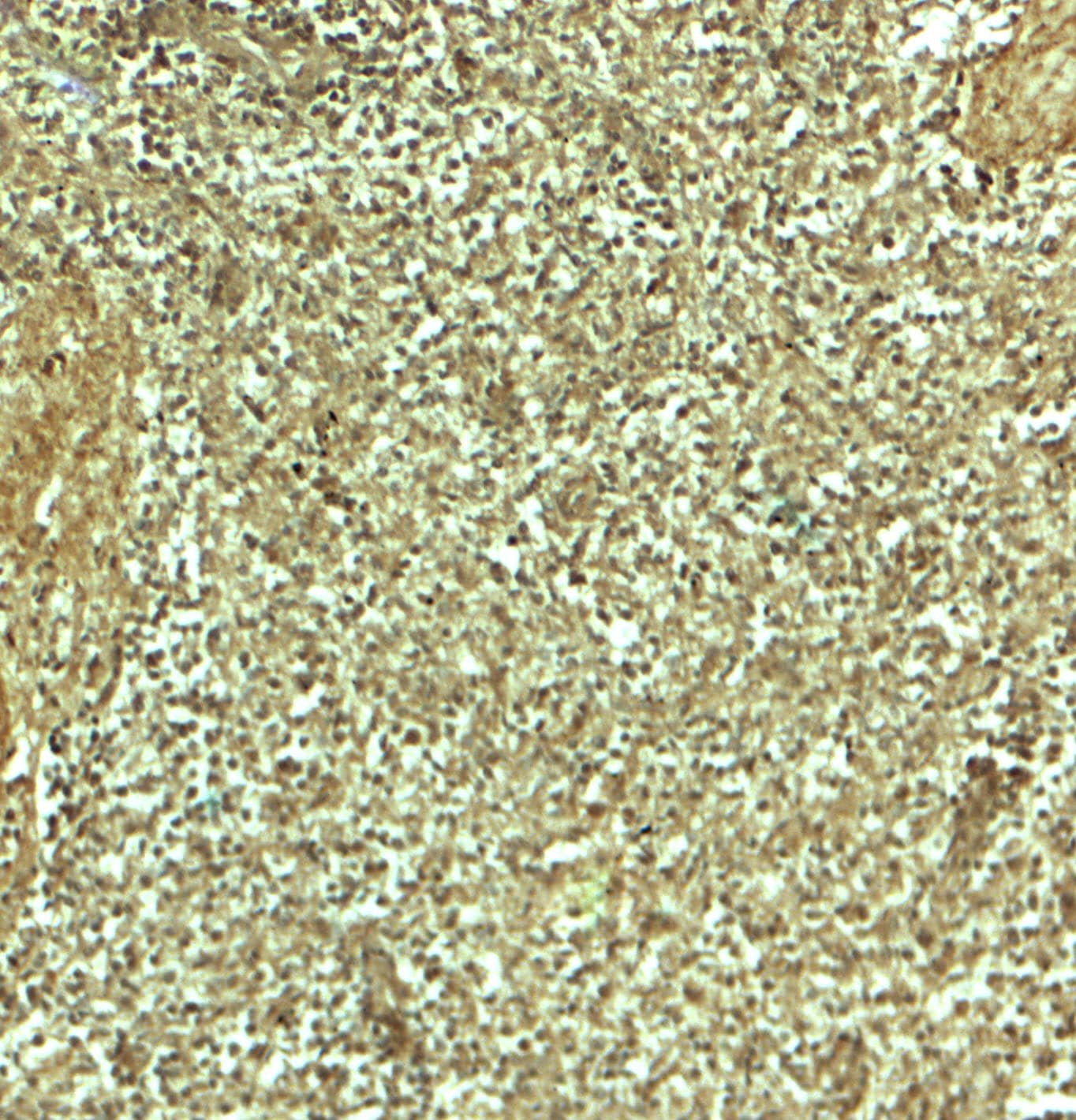 Immunohistochemistry: ADRM1 Antibody - BSA Free [NBP2-81769] - Immunohistochemistry of ADRM1 in human spleen tissue with ADRM1 antibody at 5 ug/mL.