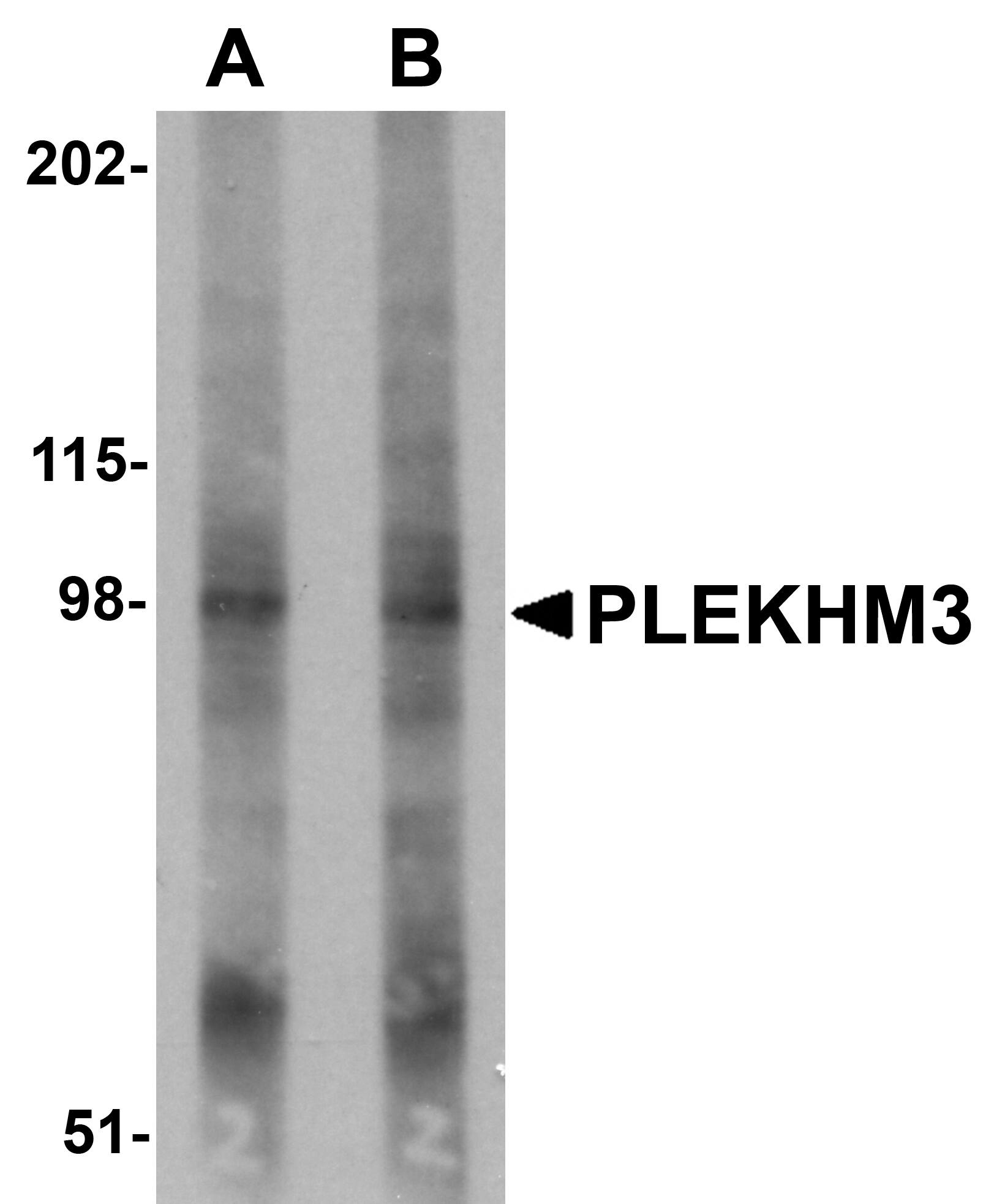 Western Blot: PLEKHM3 Antibody - BSA Free [NBP2-81770] - Western blot analysis of PLEKHM3 in mouse skeletal muscle tissue lysate with PLEKHM3 antibody at (A) 1 and (B) 2 u/mL.