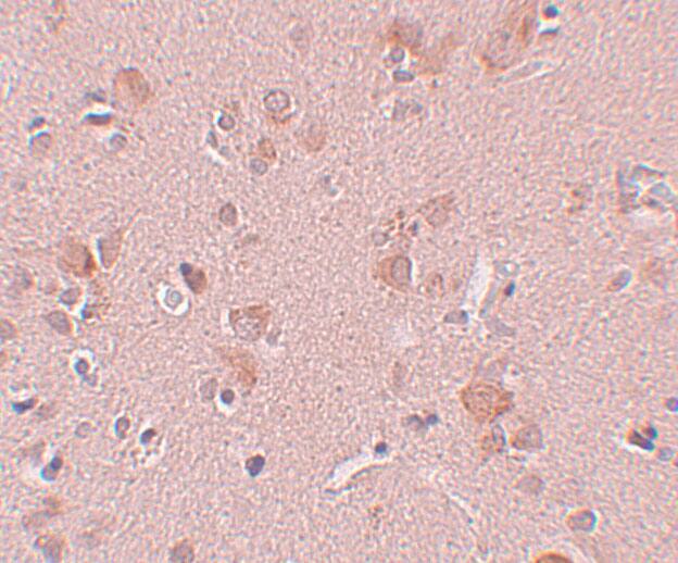 Immunohistochemistry: PLEKHM3 Antibody - BSA Free [NBP2-81770] - Immunohistochemistry of PLEKHM3 in human brain tissue with PLEKHM3 antibody at 5 u/mL.