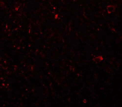 Immunocytochemistry/ Immunofluorescence: PLEKHM3 Antibody - BSA Free [NBP2-81770] - Immunofluorescence of PLKHM3 in human brain tissue with PLKHM3 antibody at 20 u/mL.
