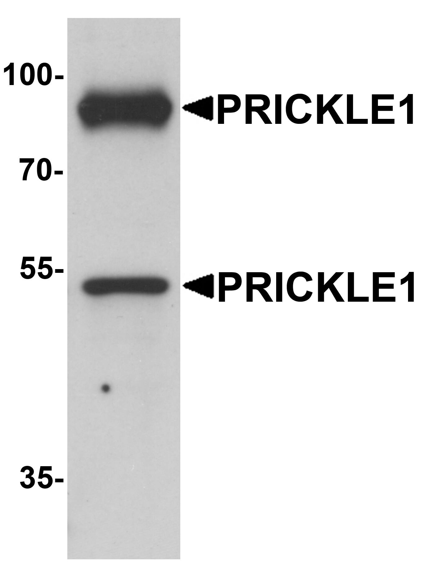 Western Blot PRICKLE1 Antibody - BSA Free