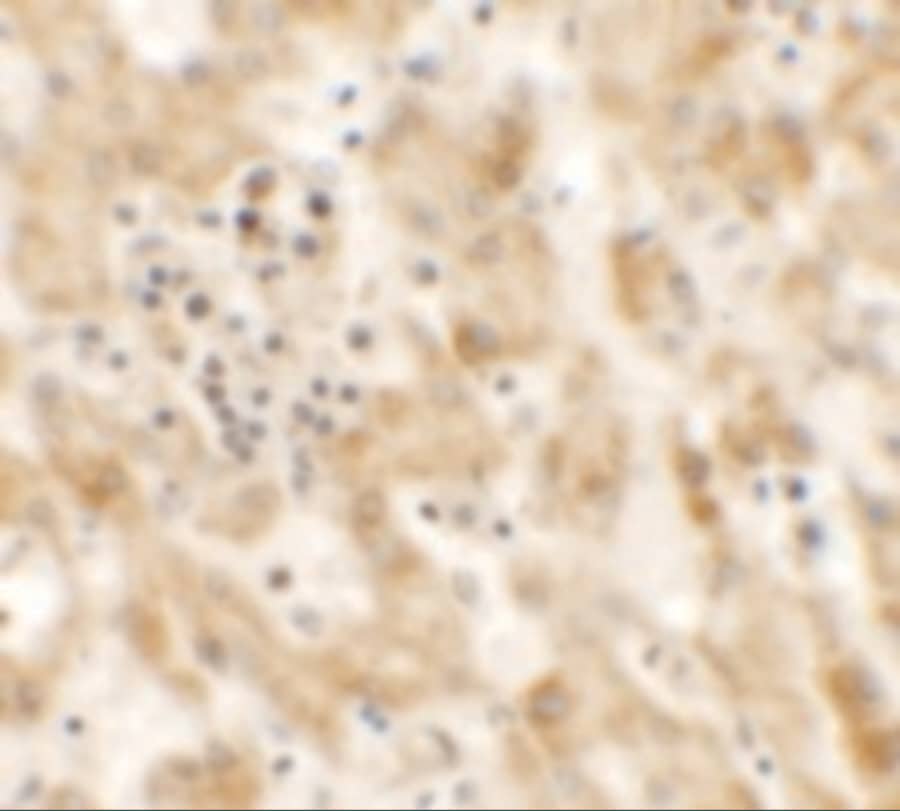 Immunohistochemistry: NKX2.8 Antibody - BSA Free [NBP2-81773] - Immunohistochemistry of NKX2.8 in human liver tissue with NKX2.8 antibody at 2.5 ug/mL.