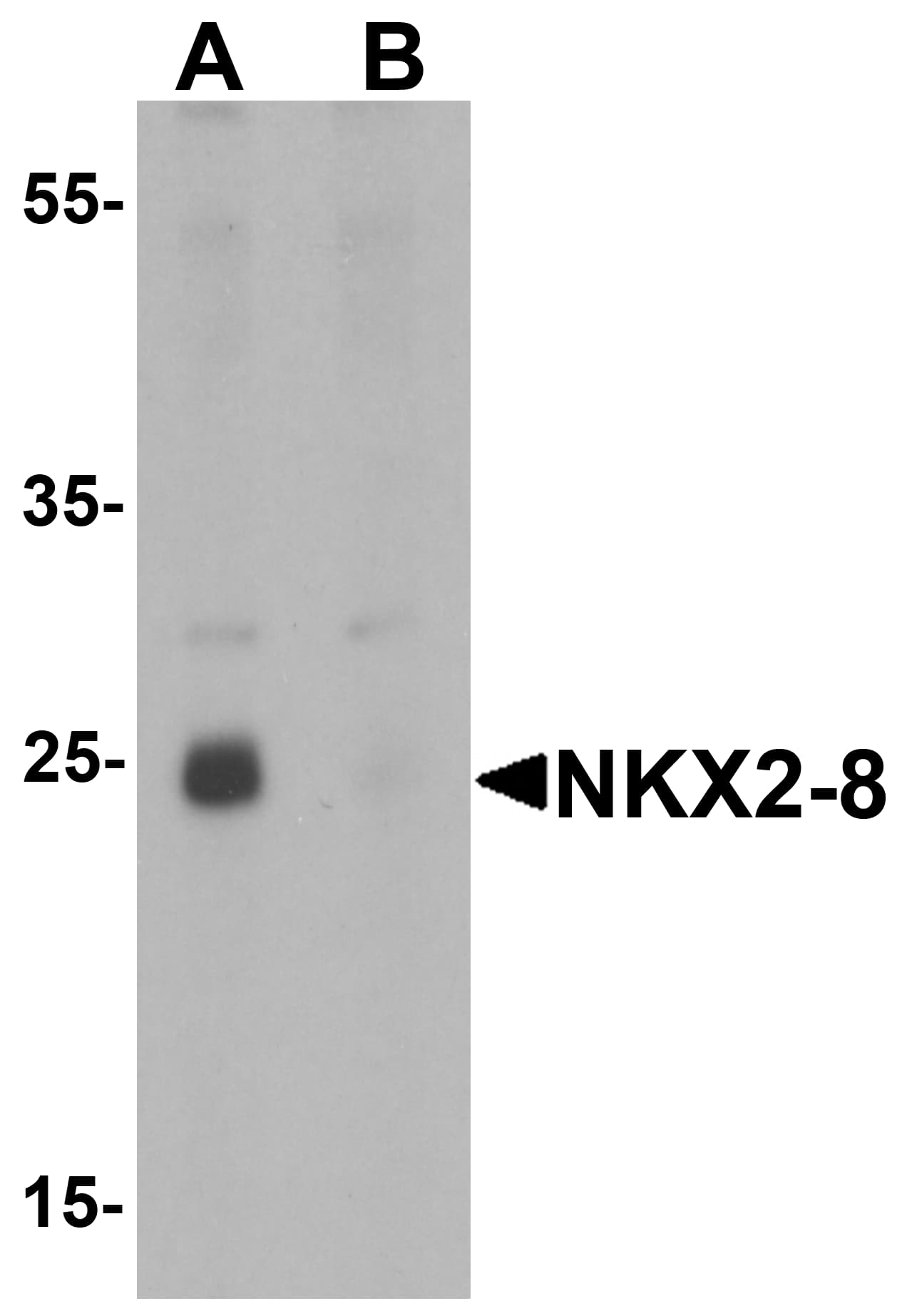 Western Blot: NKX2.8 Antibody - BSA Free [NBP2-81773] - Western blot analysis of NKX2.8 in rat liver tissue lysate with NKX2.8 antibody at 1 u/mL in (A) the absence and (B) the presence of blocking peptide