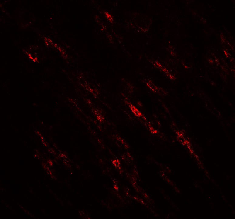 Immunocytochemistry/ Immunofluorescence POU2F3 Antibody - BSA Free