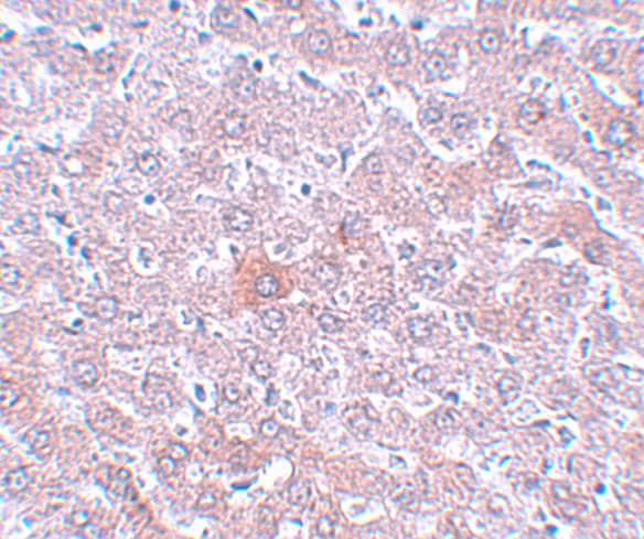 Immunohistochemistry: RSRC1 Antibody - BSA Free [NBP2-81778] - Immunohistochemistry of RSRC1 in rat liver tissue with RSRC1 antibody at 5 ug/mL.