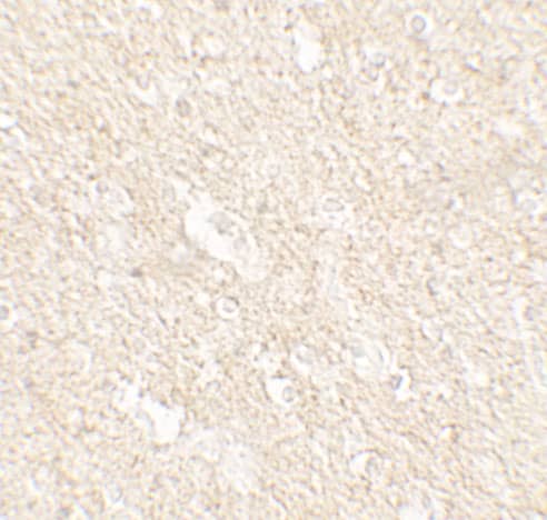 Immunohistochemistry APPBP2 Antibody - BSA Free