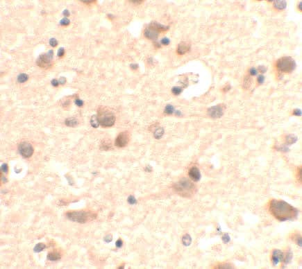 Immunohistochemistry RUSC2 Antibody - BSA Free