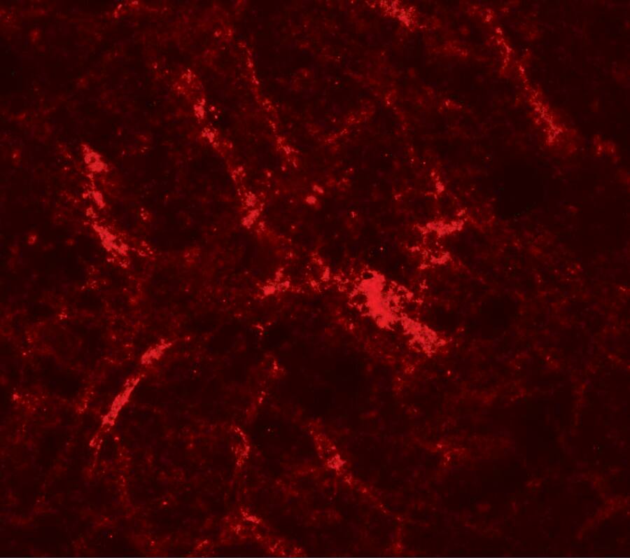 Immunocytochemistry/ Immunofluorescence RUSC2 Antibody - BSA Free