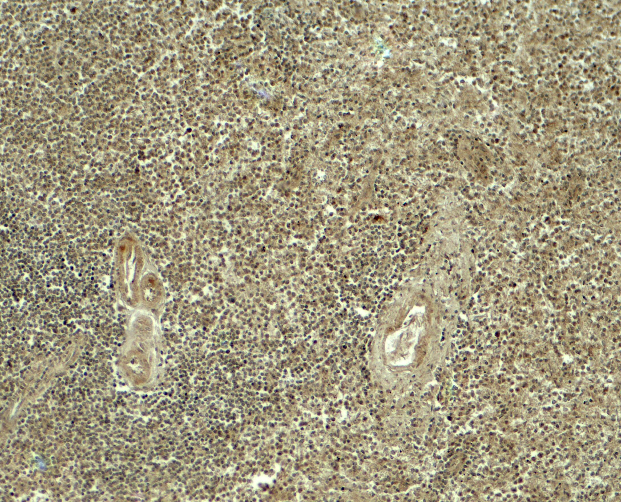 Immunohistochemistry: ATG4A Antibody - BSA Free [NBP2-81788] - Immunohistochemistry of ATG4A in human spleen tissue with ATG4A antibody at 5 u/ml.