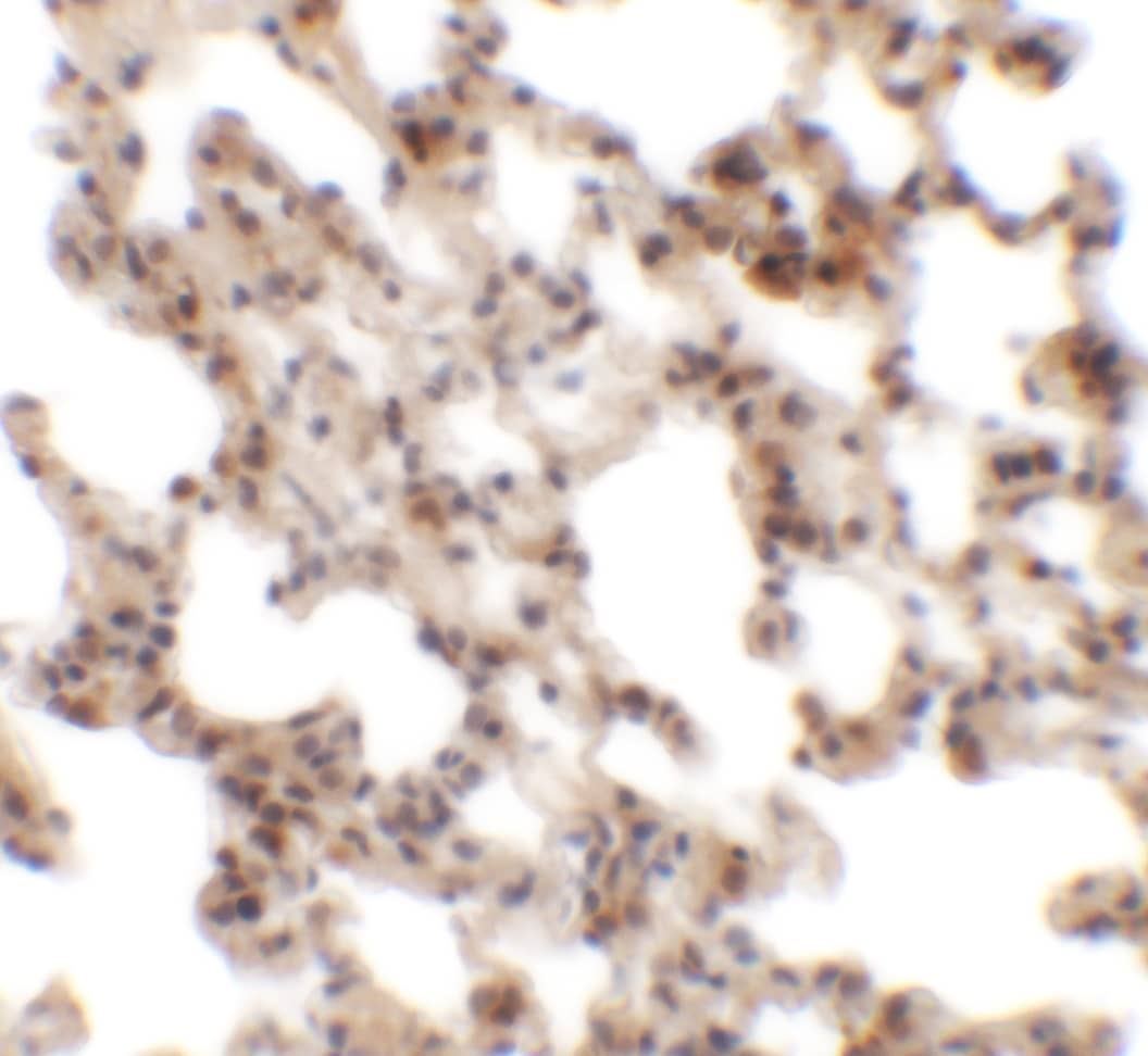 Immunohistochemistry: CORO7 Antibody - BSA Free [NBP2-81790] - Immunohistochemistry of Coronin 7 in rat lung tissue with Coronin 7 antibody at 2.5 u/mL.