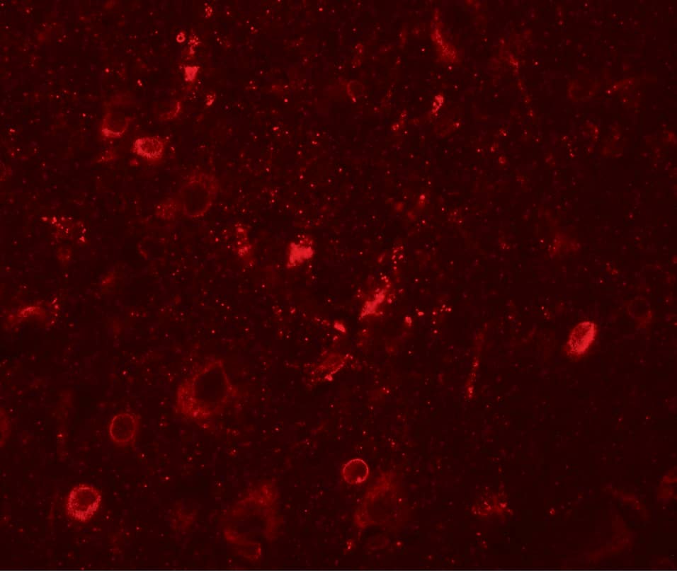 Immunocytochemistry/ Immunofluorescence SGSM1 Antibody - BSA Free