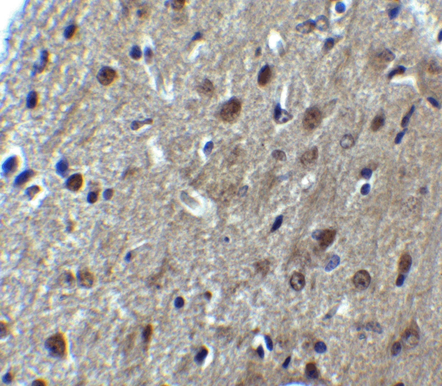 Immunohistochemistry: ARID1A Antibody - BSA Free [NBP2-81795] - Immunohistochemistry of ARID1A in mouse brain tissue with ARID1A antibody at 5 ug/mL.