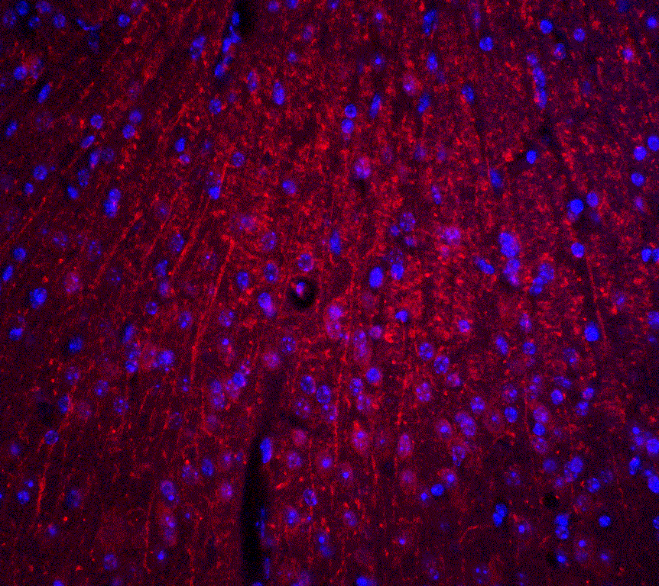 Immunocytochemistry/ Immunofluorescence: ARID1A Antibody - BSA Free [NBP2-81795] - Immunofluorescence of ARID1A in mouse brain tissue with ARID1A antibody at 20 ug/ml.