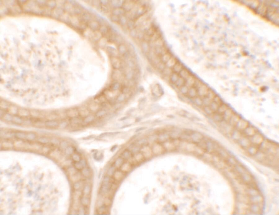 Immunohistochemistry: DIS3 Antibody - BSA Free [NBP2-81804] - Immunohistochemistry of DIS3 in mouse testis tissue with DIS3 antibody at 2.5 u/ml.