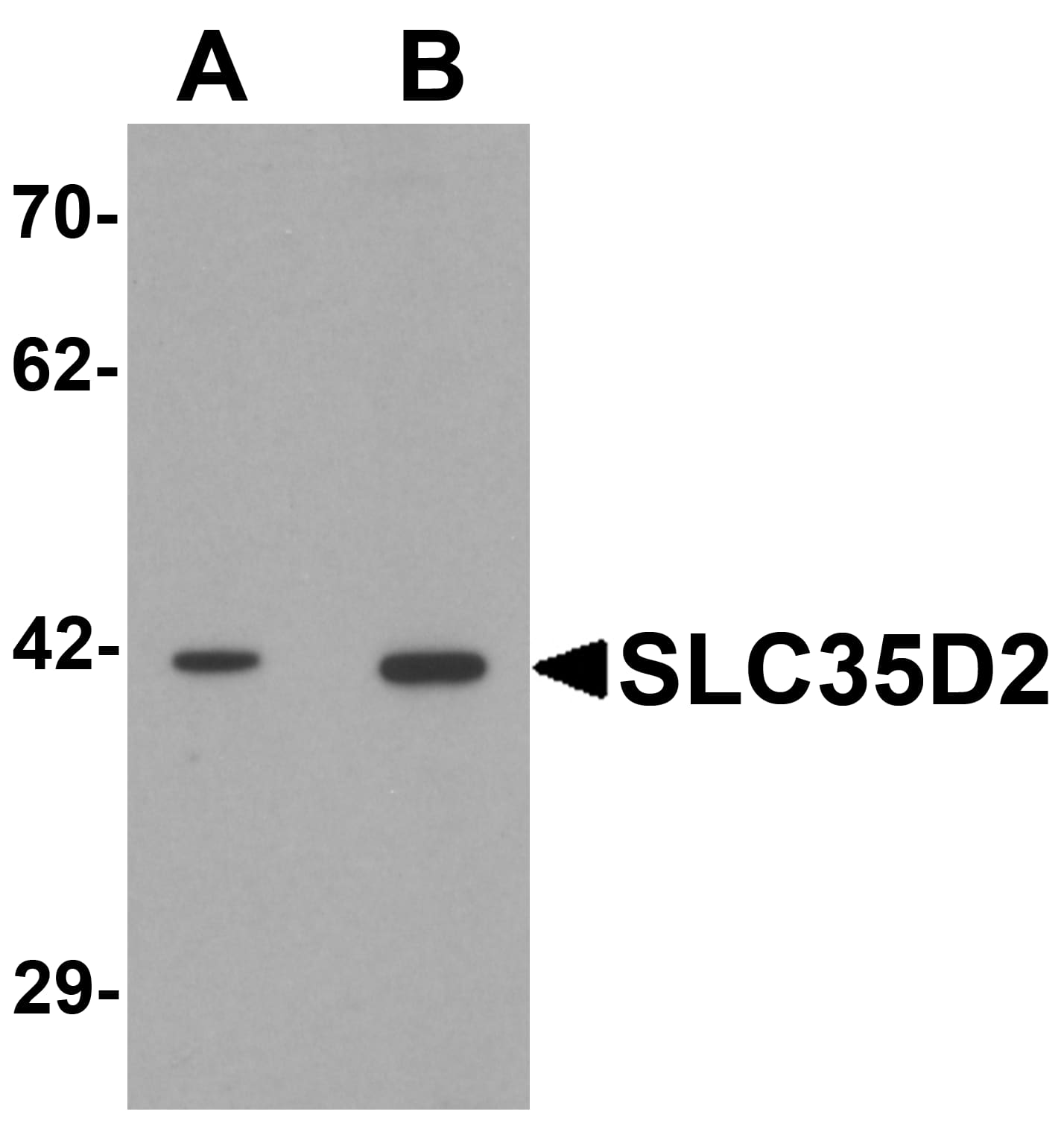 Western Blot SLC35D2 Antibody - BSA Free