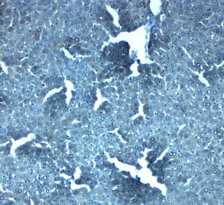 Immunohistochemistry: SLC38A4 Antibody - BSA Free [NBP2-81807] - Immunohistochemistry of SLC38A4 in mouse liver tissue with SLC38A4 antibody at 2.5 u/mL.