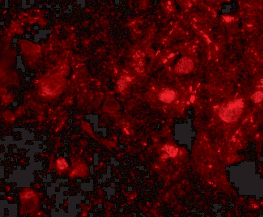 Immunocytochemistry/ Immunofluorescence SLITRK3 Antibody - BSA Free