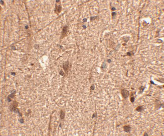 Immunohistochemistry SLITRK3 Antibody - BSA Free