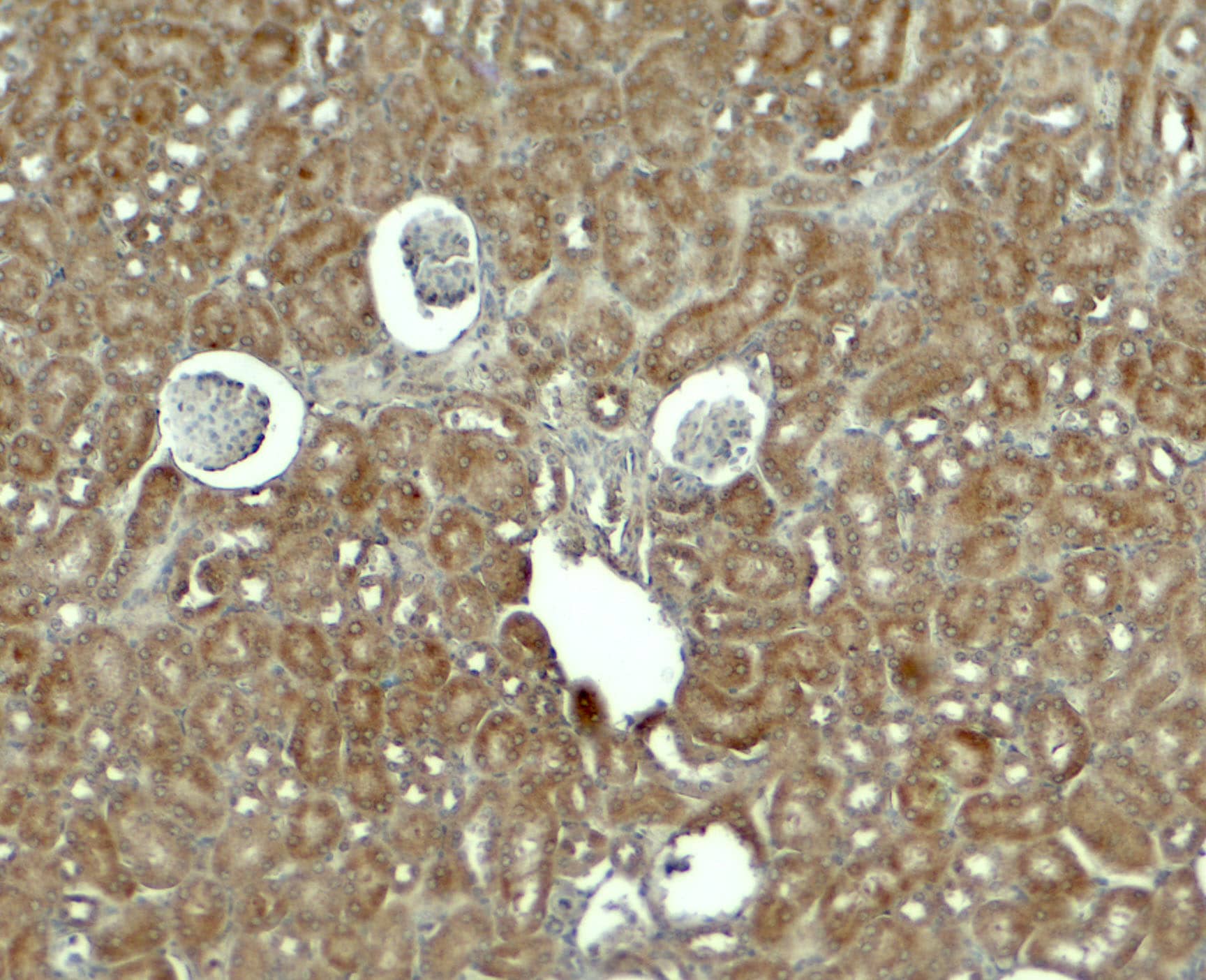 Immunohistochemistry: RhoG Antibody - BSA Free [NBP2-81812] - Immunohistochemistry of RhoG in mouse kidney tissue with RhoG antibody at 5 ug/ml.