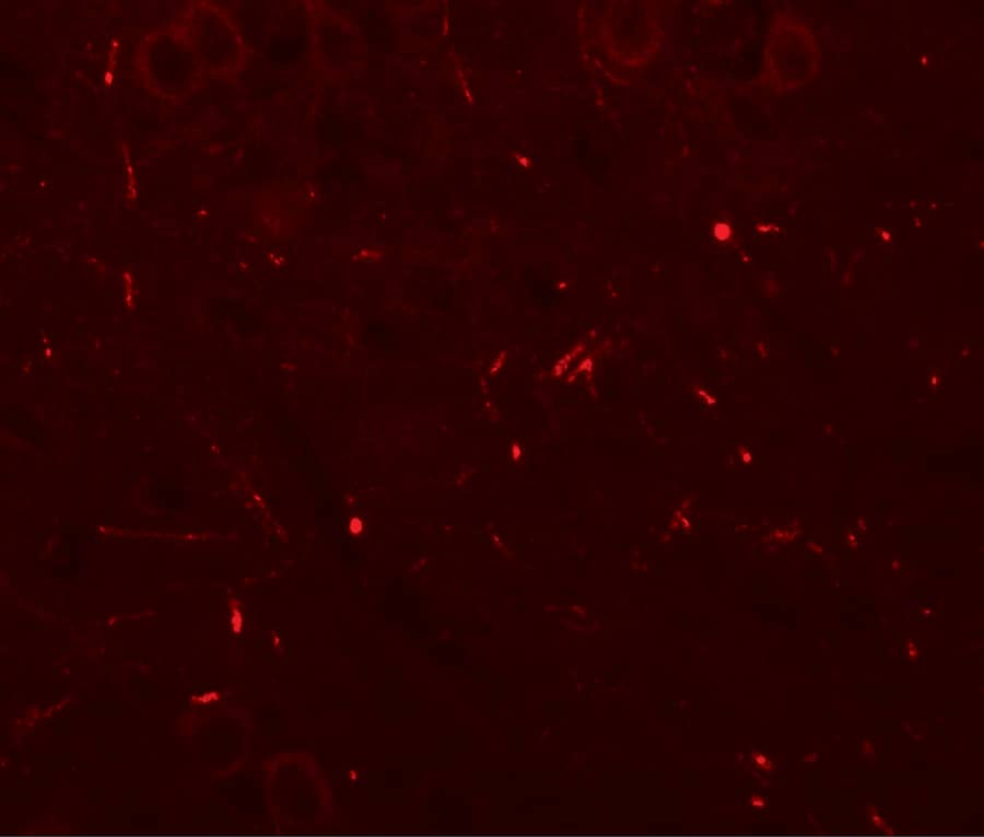 Immunocytochemistry/ Immunofluorescence: SEC62 Antibody - BSA Free [NBP2-81813] - Immunofluorescence of SEC62 in mouse brain tissue with SEC62 antibody at 20 ug/mL.