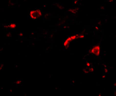 Immunocytochemistry/ Immunofluorescence: SLITRK3 Antibody - BSA Free [NBP2-81815] - Immunofluorescence of slitrk3 in human brain tissue with slitrk3 antibody at 20 ug/mL.