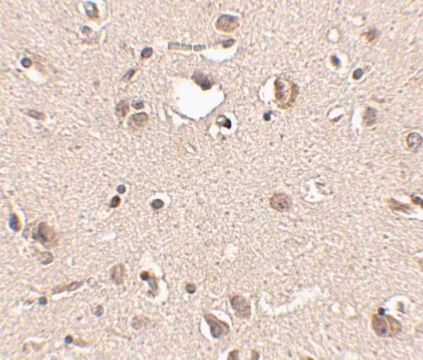 Immunohistochemistry: SLITRK3 Antibody - BSA Free [NBP2-81815] - Immunohistochemistry of SLITRK3 in human brain tissue with SLITRK3 antibody at 2.5 u/mL.
