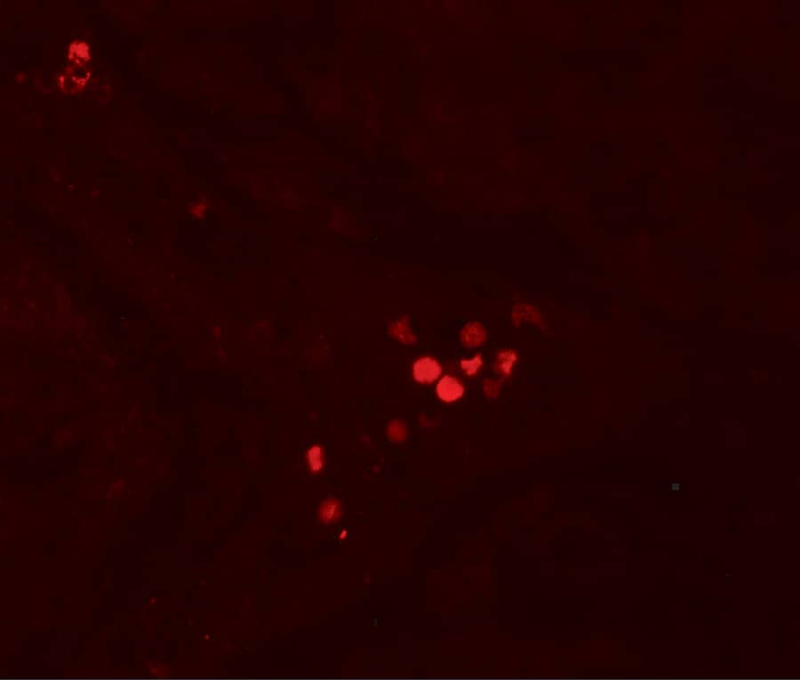 Immunohistochemistry: GBP5 Antibody - BSA Free [NBP2-81821] - Immunofluorescence of GBP5 in human liver tissue with GBP5 antibody at 20 u/ml.