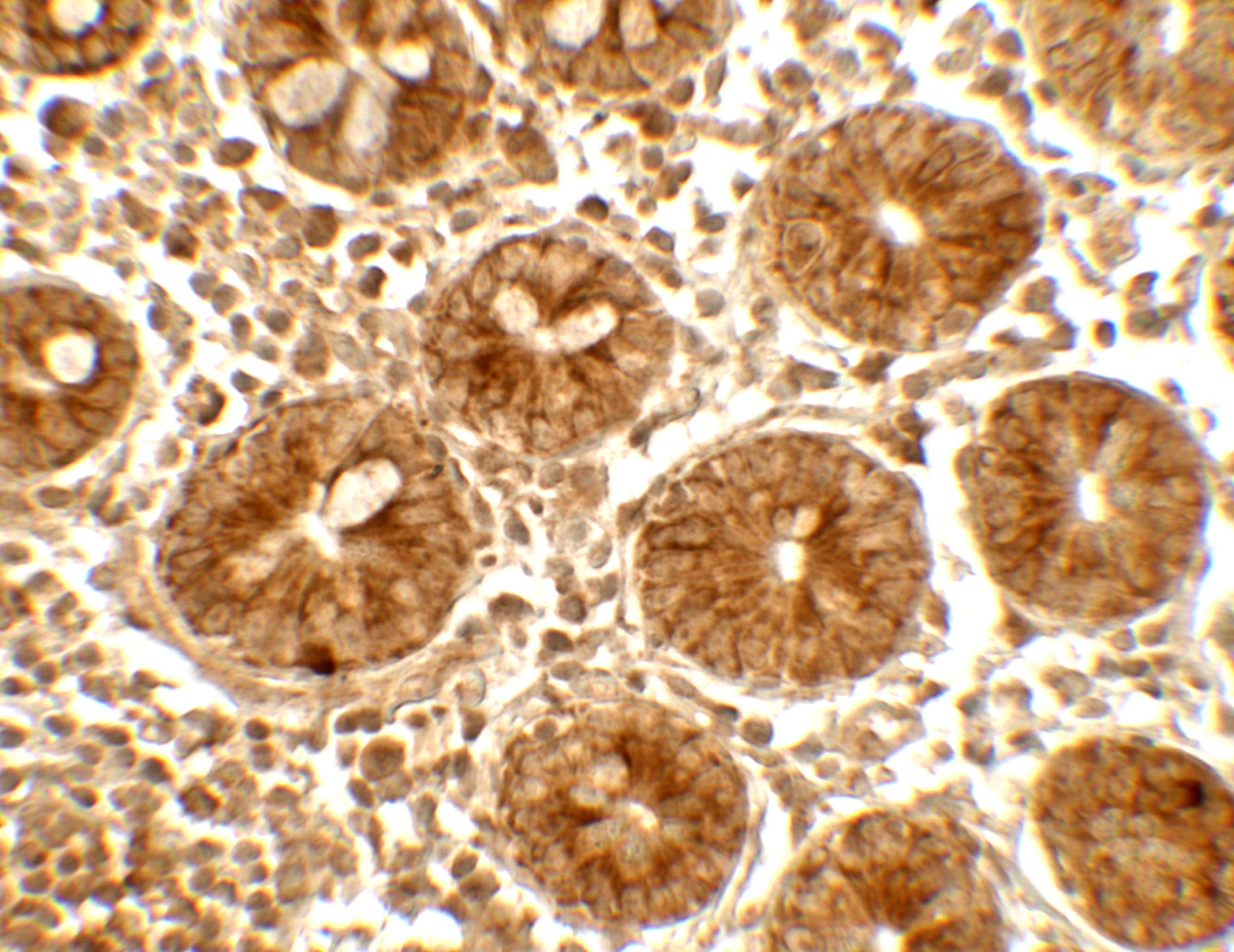 Immunohistochemistry: IFIT1 Antibody - BSA Free [NBP2-81823] - Immunohistochemistry of IFIT1 in human small intestine tissue with IFIT1 antibody at 5 u/mL.