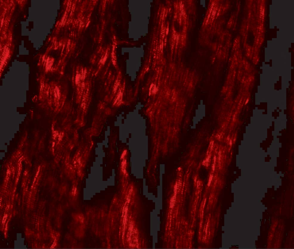 Immunocytochemistry/ Immunofluorescence: ERR beta/NR3B2 Antibody - BSA Free [NBP2-81824] - Immunofluorescence of ERR beta/NR3B2 in human heart tissue with ERR beta/NR3B2 antibody at 20 ug/mL.