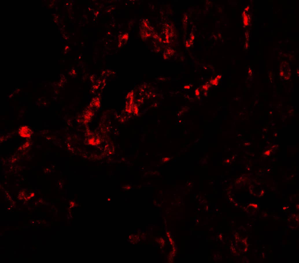 Immunocytochemistry/ Immunofluorescence: GDF-1 Antibody - BSA Free [NBP2-81826] - Immunofluorescence of GDF-1 in human lung tissue with GDF-1 antibody at 20 ug/mL.