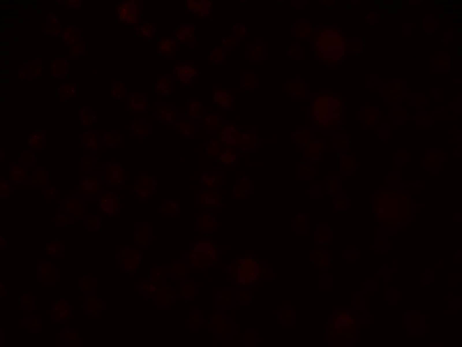 Immunocytochemistry/ Immunofluorescence SLAIN1 Antibody - BSA Free