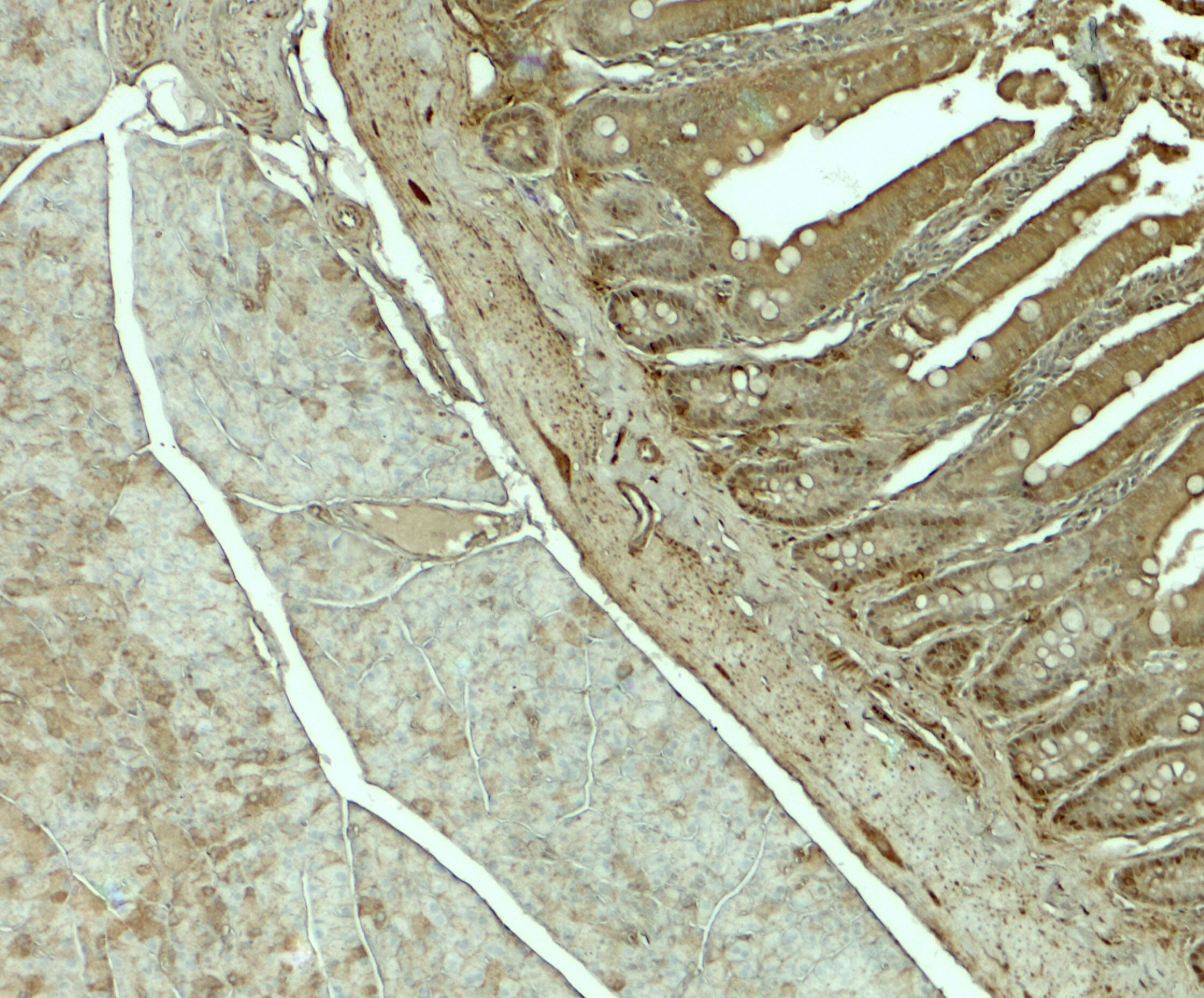 Immunohistochemistry: SLC29A3 Antibody - BSA Free [NBP2-81829] - Immunohistochemistry of SLC29A3 in rat colon tissue with SLC29A3 antibody at 5 u/mL.