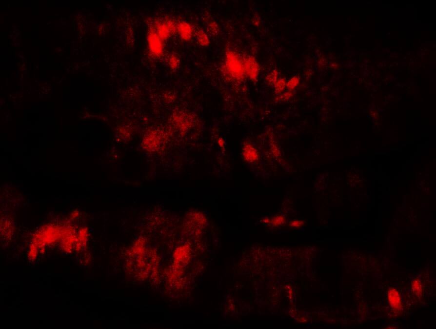 Immunocytochemistry/ Immunofluorescence: SLC29A3 Antibody - BSA Free [NBP2-81829] - Immunofluorescence of SLC29A3 in rat colon muscle tissue with SLC29A3 antibody at 20 u/mL.