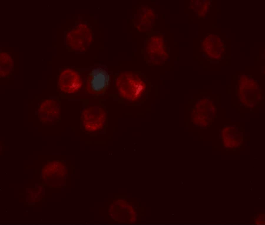 Immunocytochemistry/ Immunofluorescence: TCTEX1D1 Antibody - BSA Free [NBP2-81830] - Immunofluorescence of TCTEX1D1 in K562 cells with TCTEX1D1 antibody at 20 ug/mL.