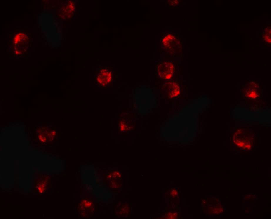 Immunocytochemistry/ Immunofluorescence: TCTEX1D2 Antibody - BSA Free [NBP2-81831] - Immunofluorescence of TCTEX1D2 in K562 cells with TCTEX1D2 antibody at 20 ug/mL.