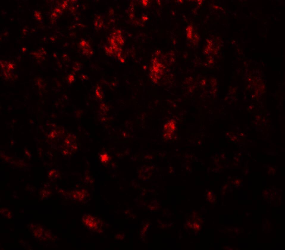 Immunocytochemistry/ Immunofluorescence: IGSF4B/SynCAM3/CADM3 Antibody - BSA Free [NBP2-81834] - Immunofluorescence of IGSF4B/SynCAM3/CADM3 in mouse brain tissue with IGSF4B/SynCAM3/CADM3 antibody at 20 u/ml.