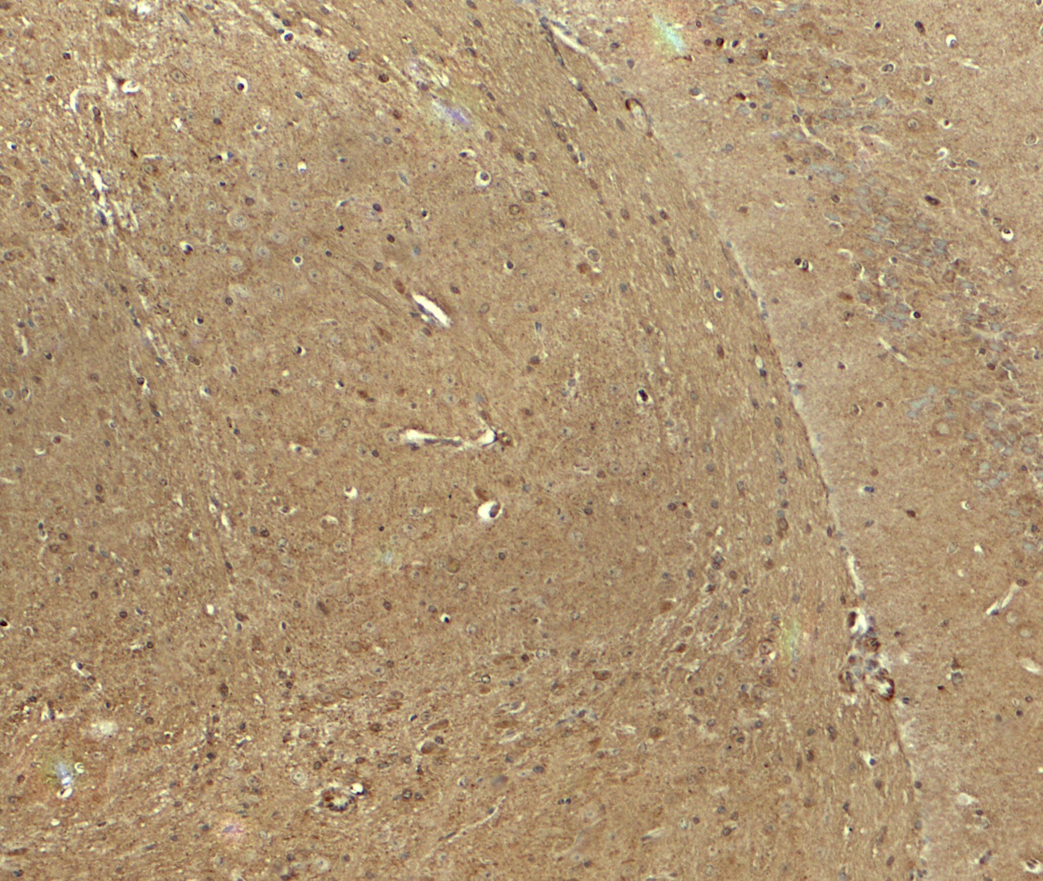 Immunohistochemistry: IGSF4B/SynCAM3/CADM3 Antibody - BSA Free [NBP2-81834] - Immunohistochemistry of IGSF4B/SynCAM3/CADM3 in mouse brain tissue with IGSF4B/SynCAM3/CADM3 antibody at 5 u/ml.