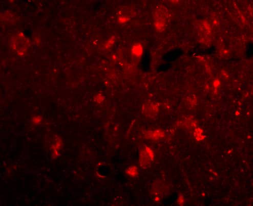 Immunocytochemistry/ Immunofluorescence SLITRK2 Antibody - BSA Free