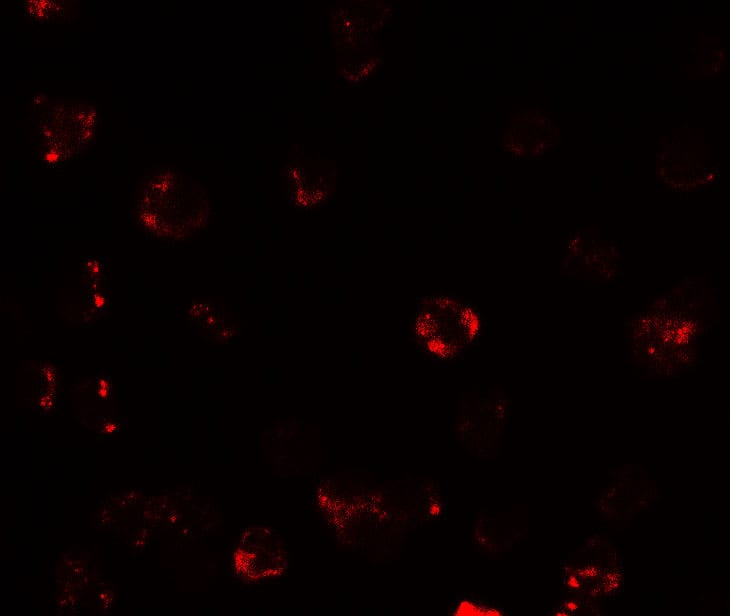 Immunocytochemistry/ Immunofluorescence: TESPA1 Antibody - BSA Free [NBP2-81842] - Immunofluorescence of TESPA1 in A431 cells with TESPA1 antibody at 20 ug/mL.
