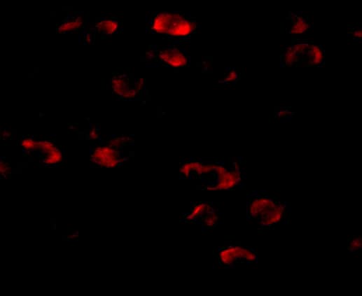 Immunocytochemistry/ Immunofluorescence TMEM18 Antibody - BSA Free