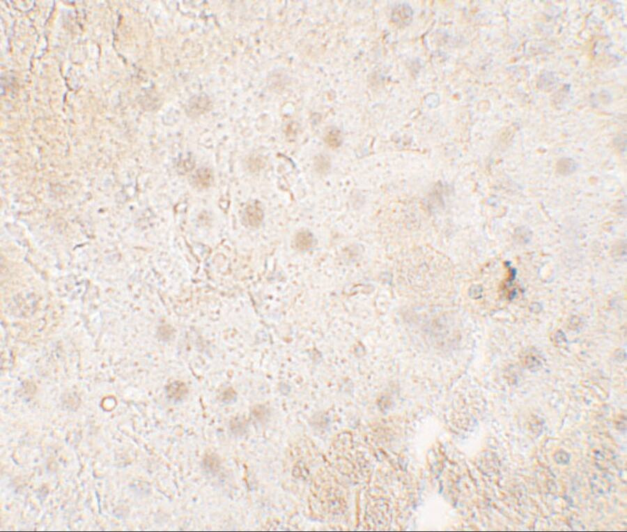 Immunohistochemistry: TMIGD1 Antibody - BSA Free [NBP2-81844] - Immunohistochemistry of TMIGD1 in mouse liver tissue with TMIGD1 antibody at 5 ug/mL.