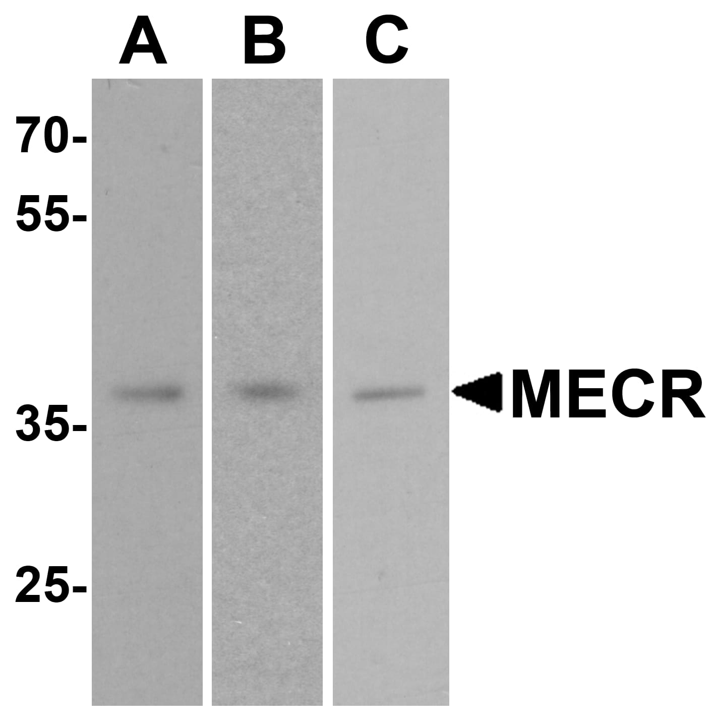 Western Blot: MECR Antibody - BSA Free [NBP2-81846] - Western blot analysis of MECR in (A) human brain tissue, (B) mouse brain tissue, and (C) rat brain tissue lysate with MECR antibody at 1 ug/mL.