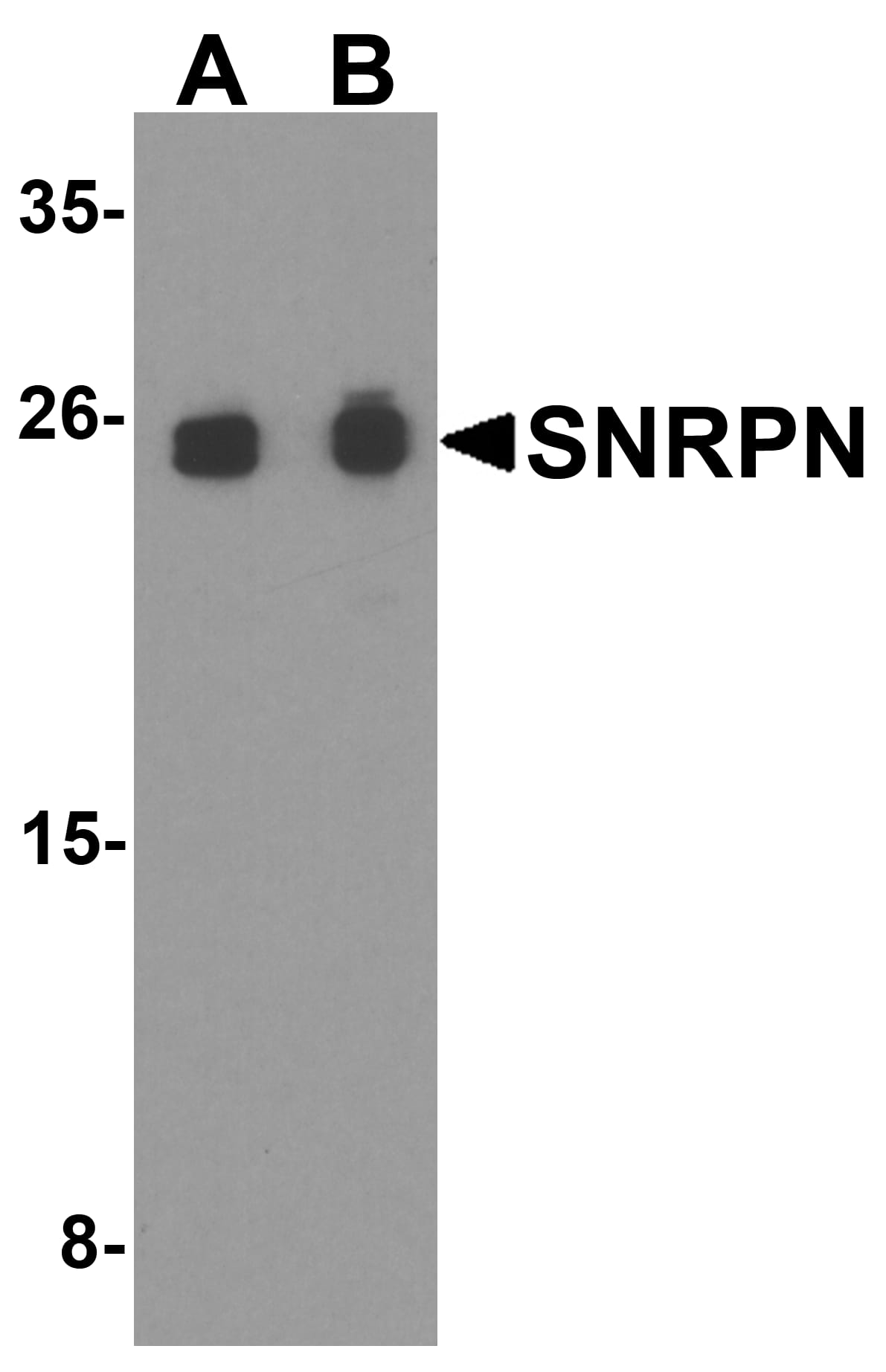 Western Blot: SNRPN Antibody - BSA Free [NBP2-81851] - Western blot analysis of SNRPN in THP-1 cell lysate with SNRPN antibody at (A) 0.5 and (B) 1 u/ml.