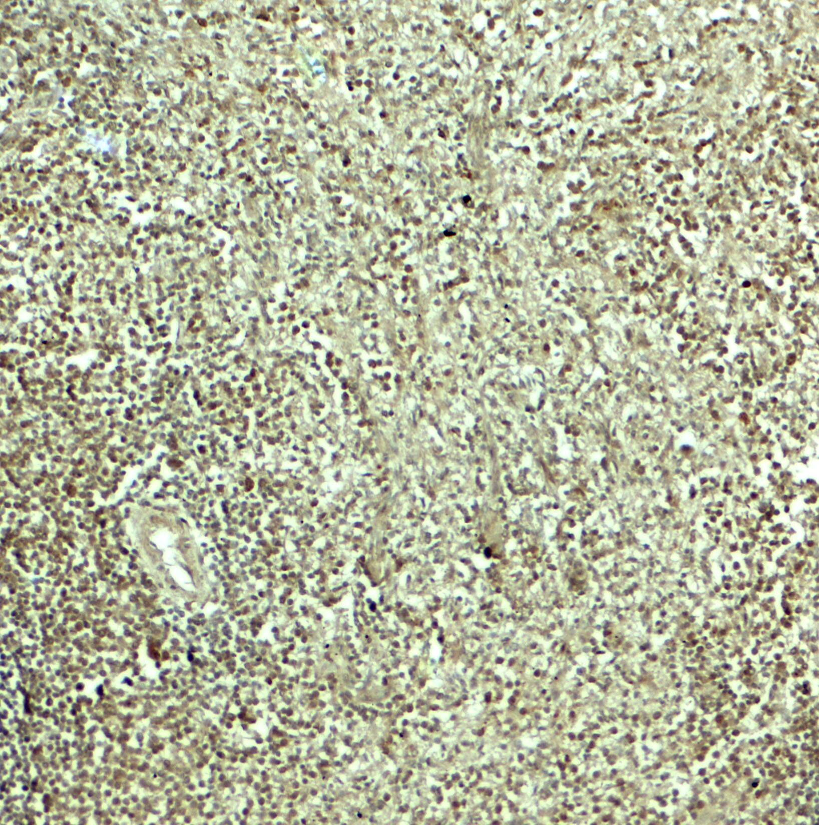 Immunohistochemistry: SNRPN Antibody - BSA Free [NBP2-81851] - Immunohistochemistry of SNRPN in human spleen tissue with SNRPN antibody at 5 u/mL.